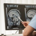 Dokter menunjukkan hasil scan otak pasien pada layar komputer untuk mendeteksi adanya tumor.